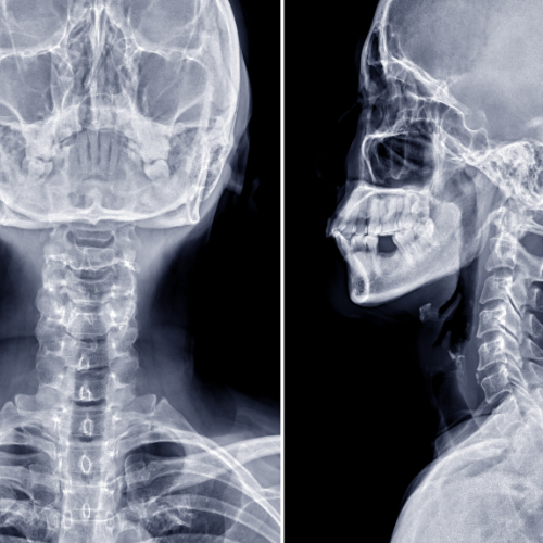 Radiologie | Votre diagnostic rapide — RF2IM