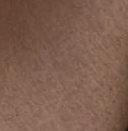 Close-up of a person's skin, showing a textured, brown complexion.