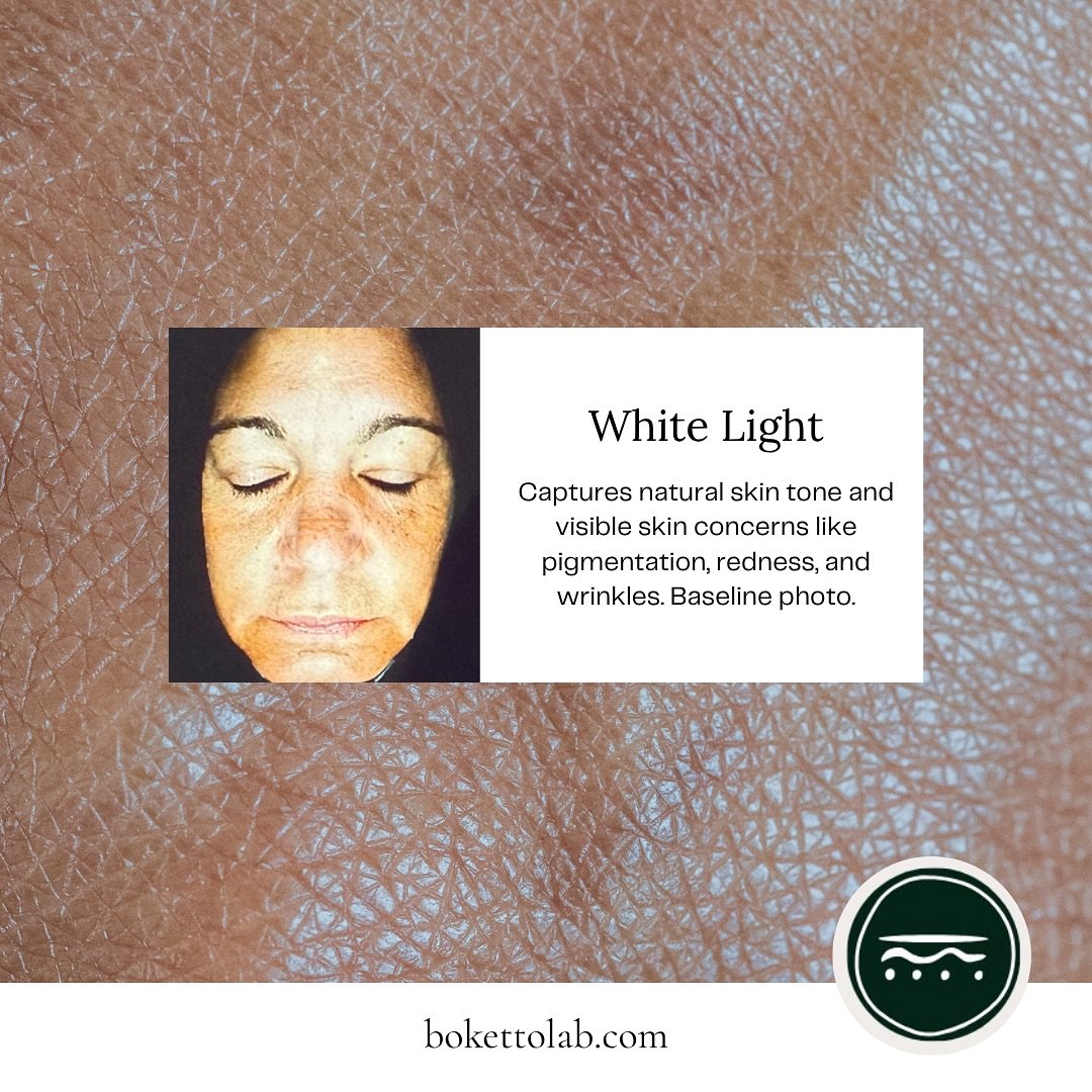 ✨ Ever wondered what your skin really looks like beneath the surface? Our skin analysis tool doesn&rsquo;t just take a picture, it tells a story. Each scan reveals something unique, from sun damage to hydration levels, collagen loss, and even bacteri