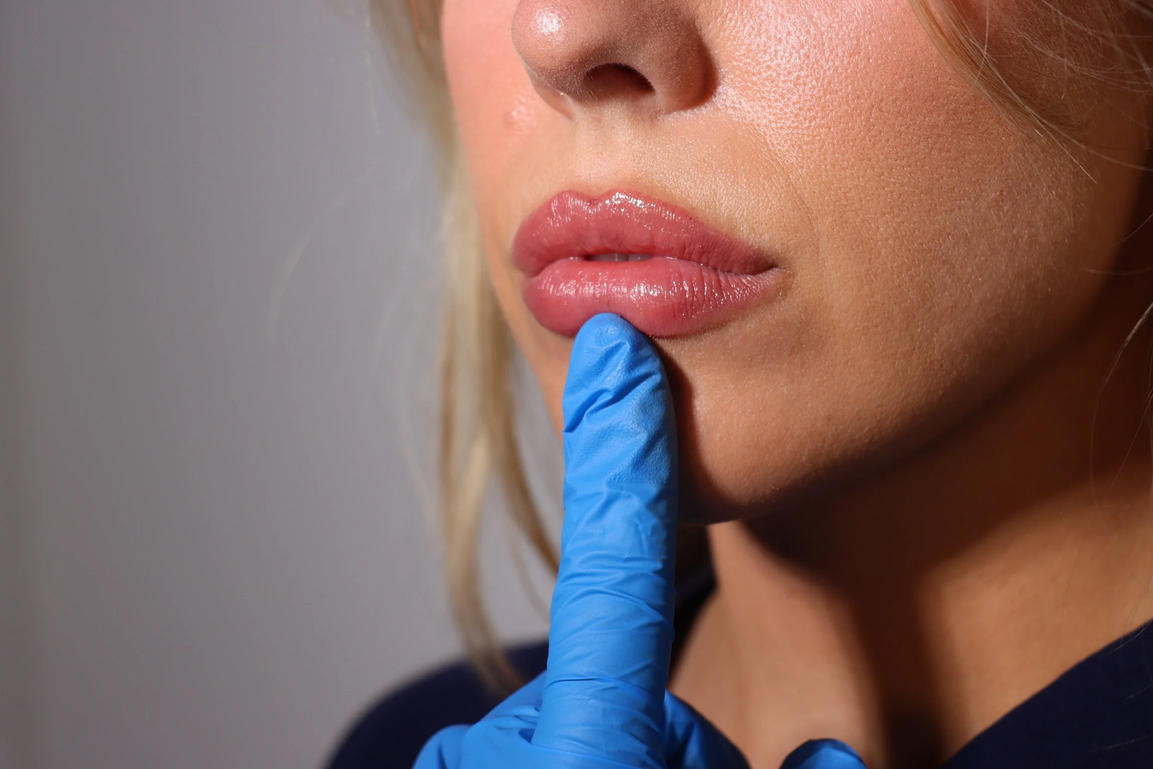 Cosmetic injector’s gloved hand assessing a client’s lips with high-shine gloss, captured during an aesthetic evaluation.