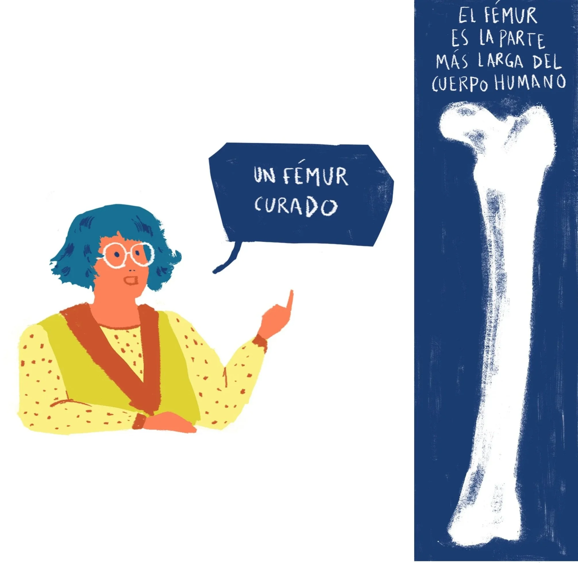 A healed femur.
The femur is the longest part of human body