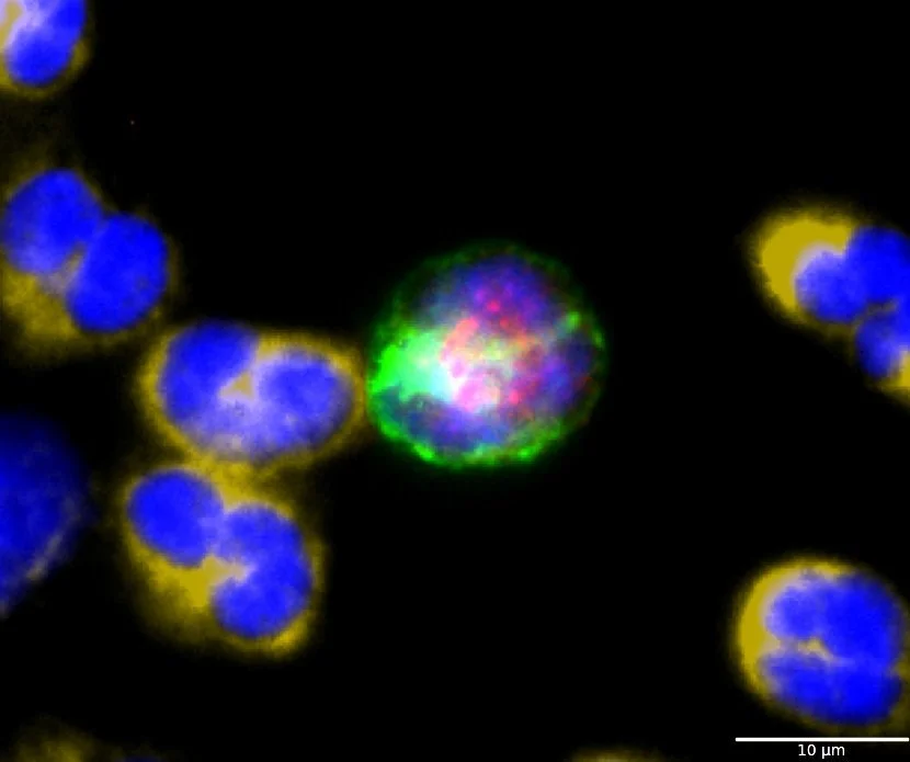 Circulating Tumor Cells (CTCs)