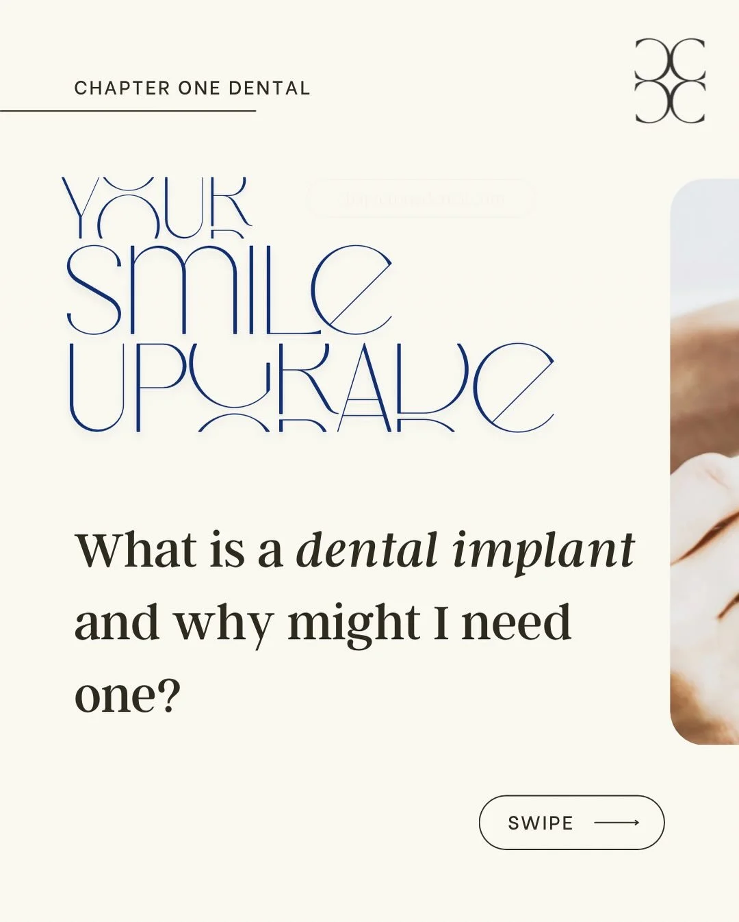 Implants offer a huge advantage to those of us missing teeth. We are so proud to offer this treatment at Chapter One. With state of the art equipment and experienced clinicians, we are your one stop shop for the best implant dentistry has to offer, a