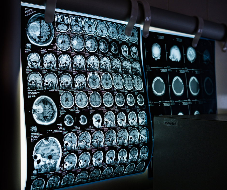 Why Clean Imaging Doesn’t Mean You’re Fine