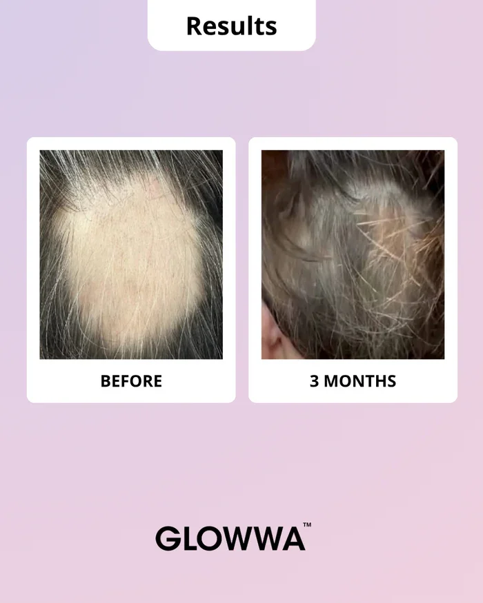 glowwa before after 3.webp
