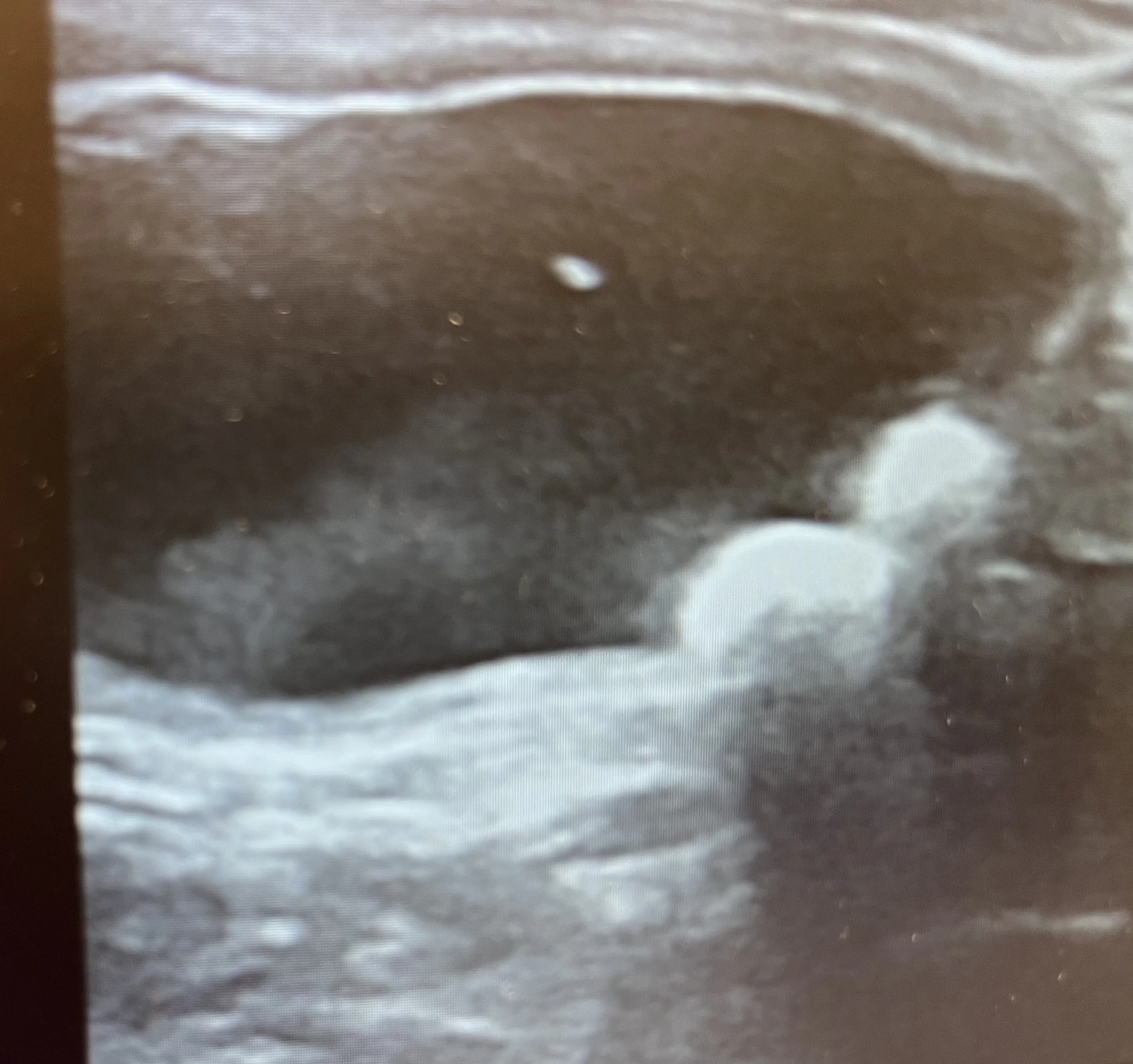 Bilden visar urinsten i urinblåsan hos en katt