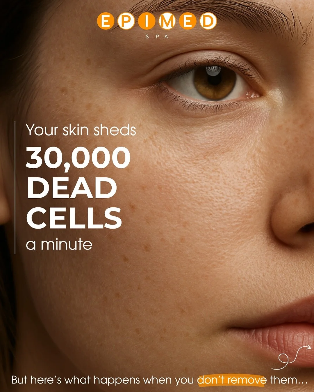 Ever wonder why your skin looks dull even with great products?
Dead skin cells and peach fuzz could be in the way.

Dermaplaning gently removes that buildup &mdash; revealing smoother, brighter skin instantly.🧡

Ready to glow? ✨

📍 EpiMed Spa &ndas