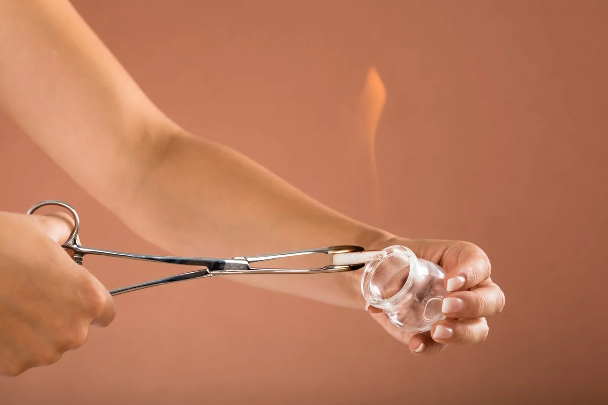 Ervaar totale ontspanning tijdens en na deze bijzondere treatment, met één van de oudste technieken die we kennen. Een vuur cup behandeling activeert het parasympatische systeem, wat zorgt voor volledige rust en ontspanning.