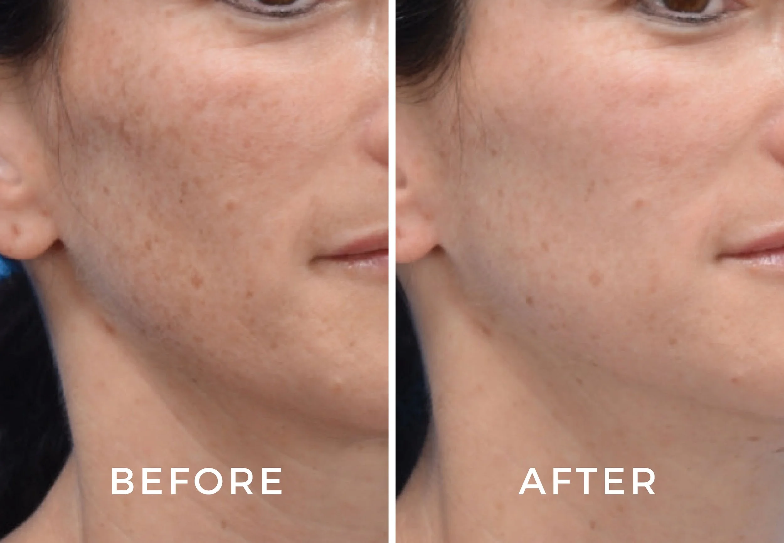 Moxi Before and Afters-02.jpg