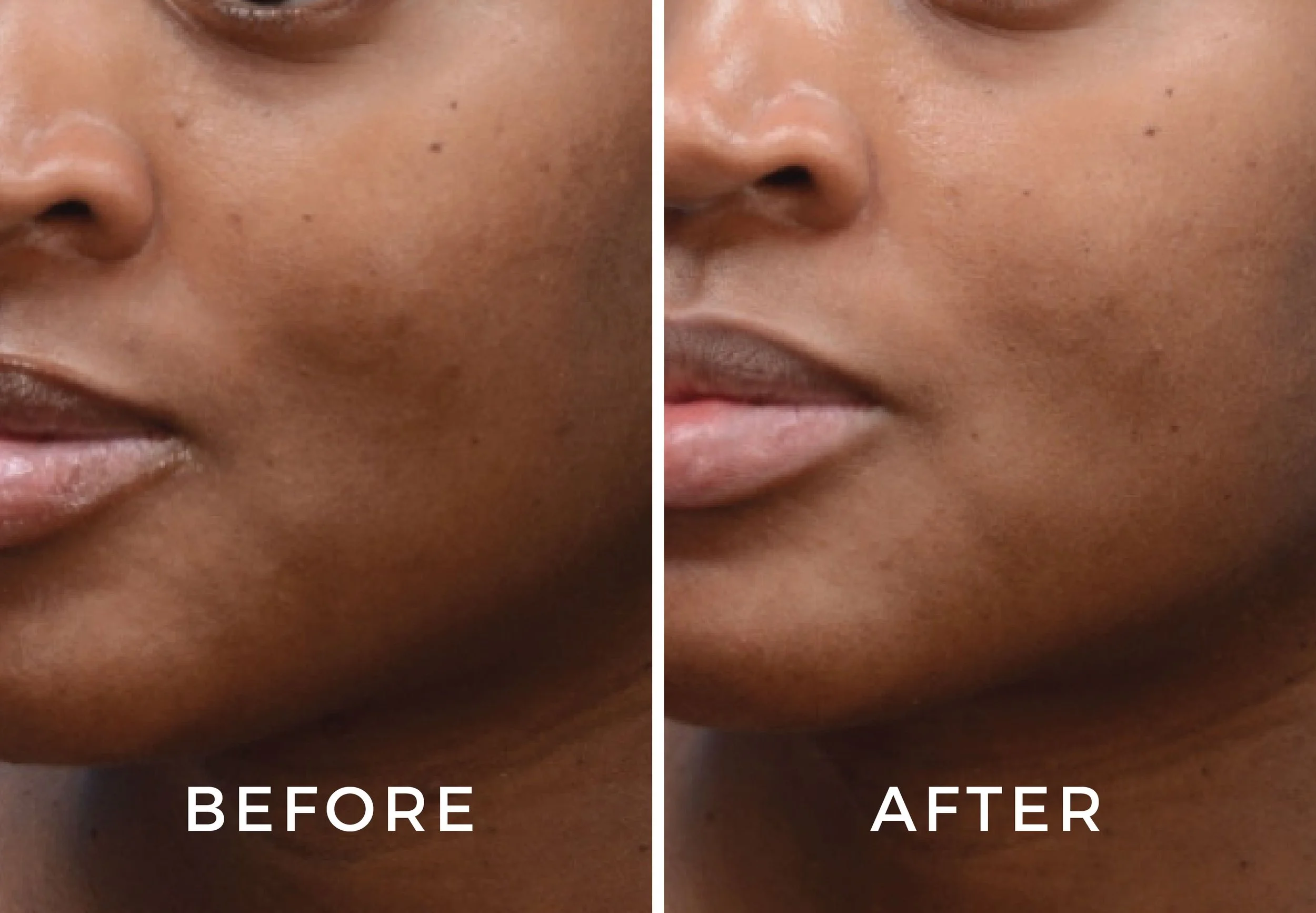 Moxi Before and Afters-03.jpg