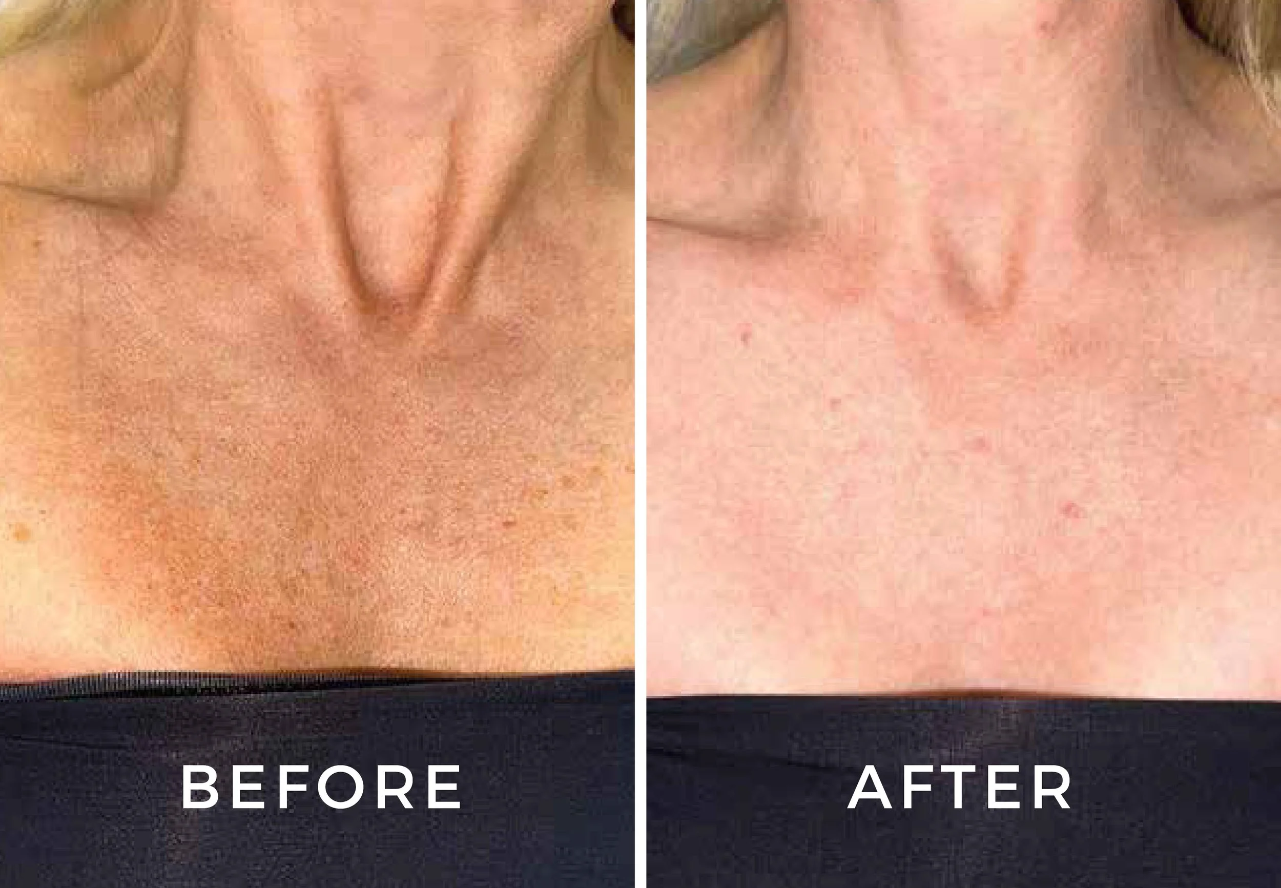 BBL Before and Afters-05.jpg