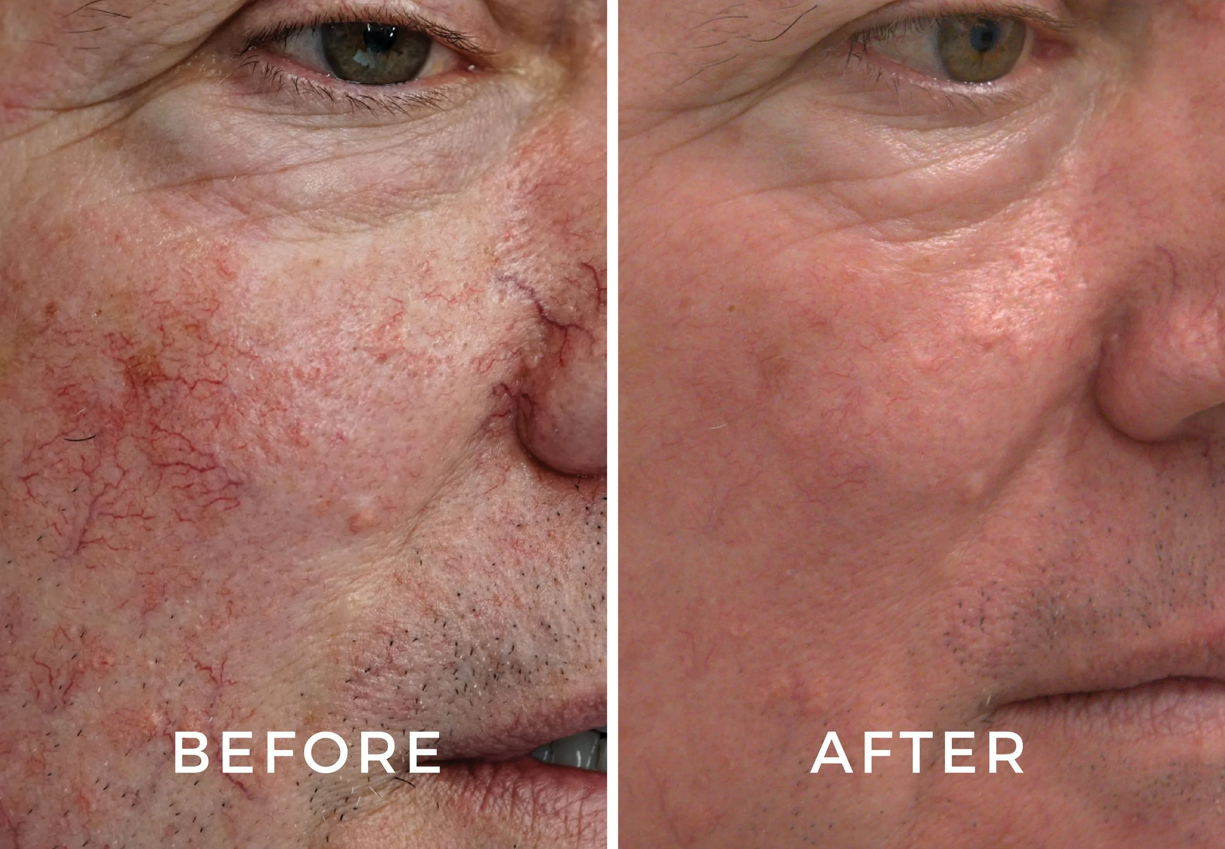 BBL Before and Afters-06.jpg