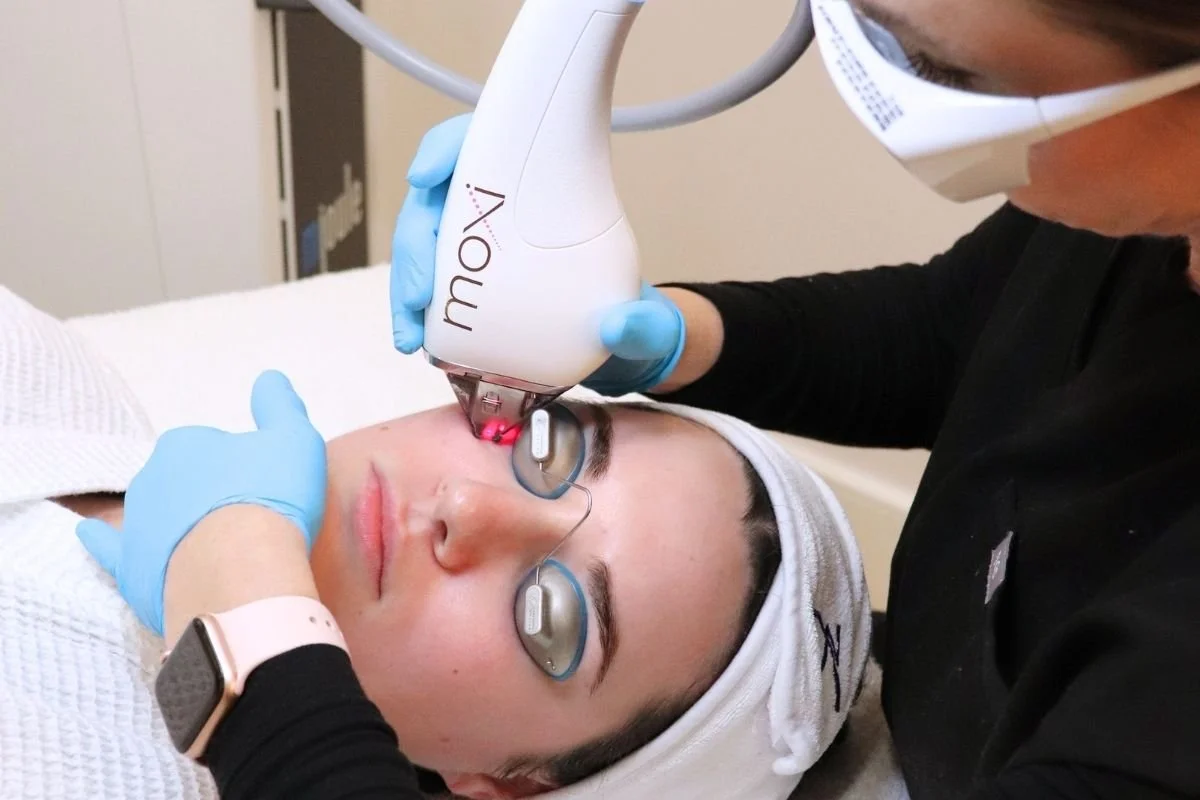 MOXI Laser in Baton Rouge: What It Treats, How It Works, and What to Expect