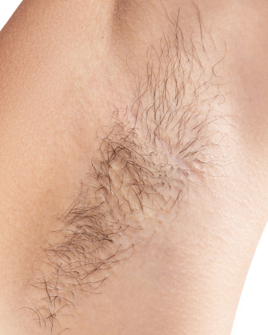 image of underarm hair on a light skin pserson