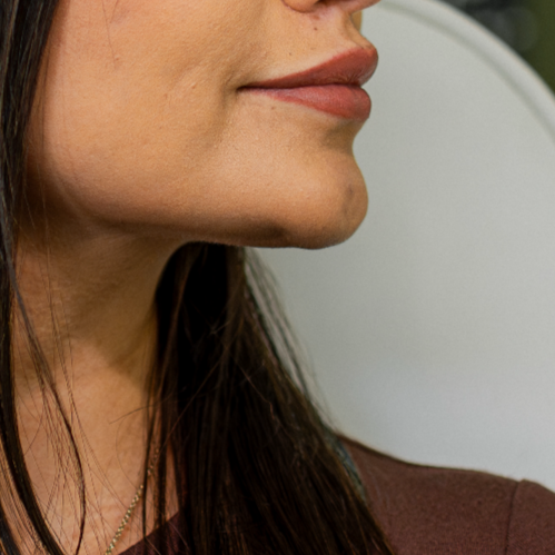 Before mini lip enhancement 