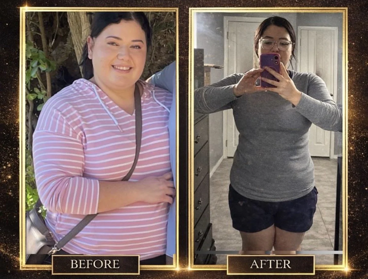 Weight-loss transformation before and after GLP injection treatment with Velura Aesthetics mobile medspa in McAllen and RGV