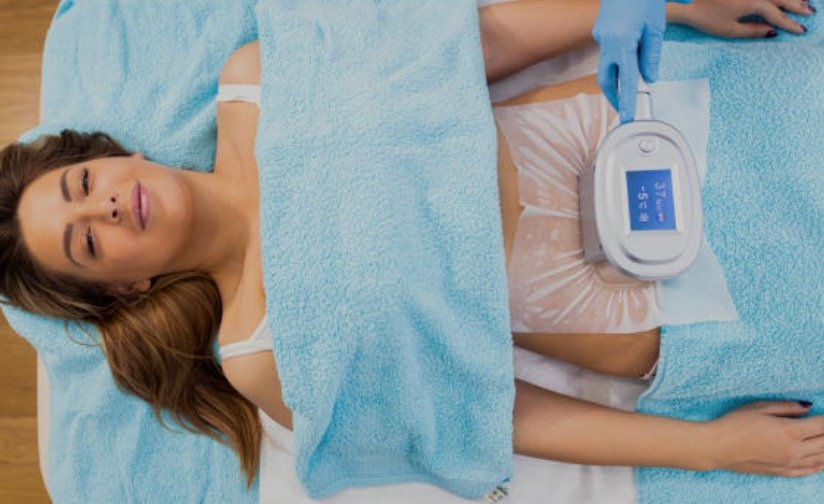 Cryolipolysis Individual Session