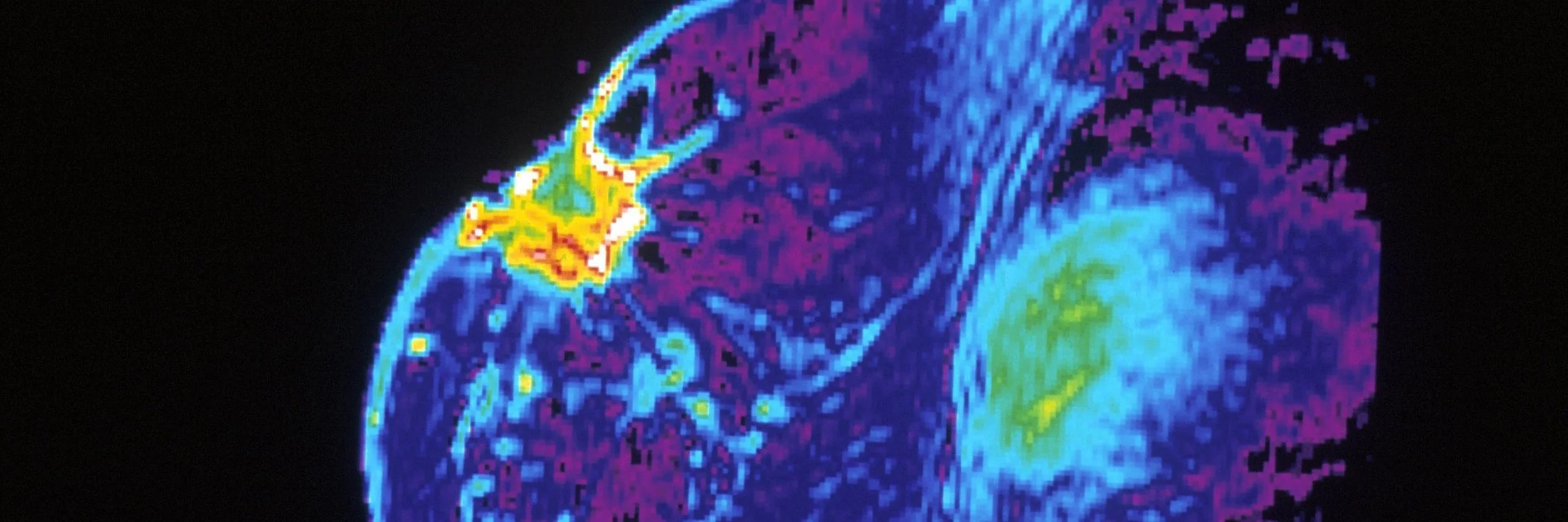 The Generations Study research highlights gaps in breast cancer risk referral guidelines