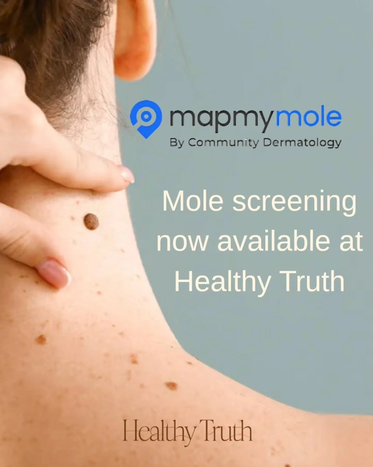 I&rsquo;m excited to share that I am now a Map My Mole clinic.

This service gives you fast, affordable access to expert mole and skin lesion checks without the long wait for GP or dermatology appointments.

Your mole or lesion is photographed here a