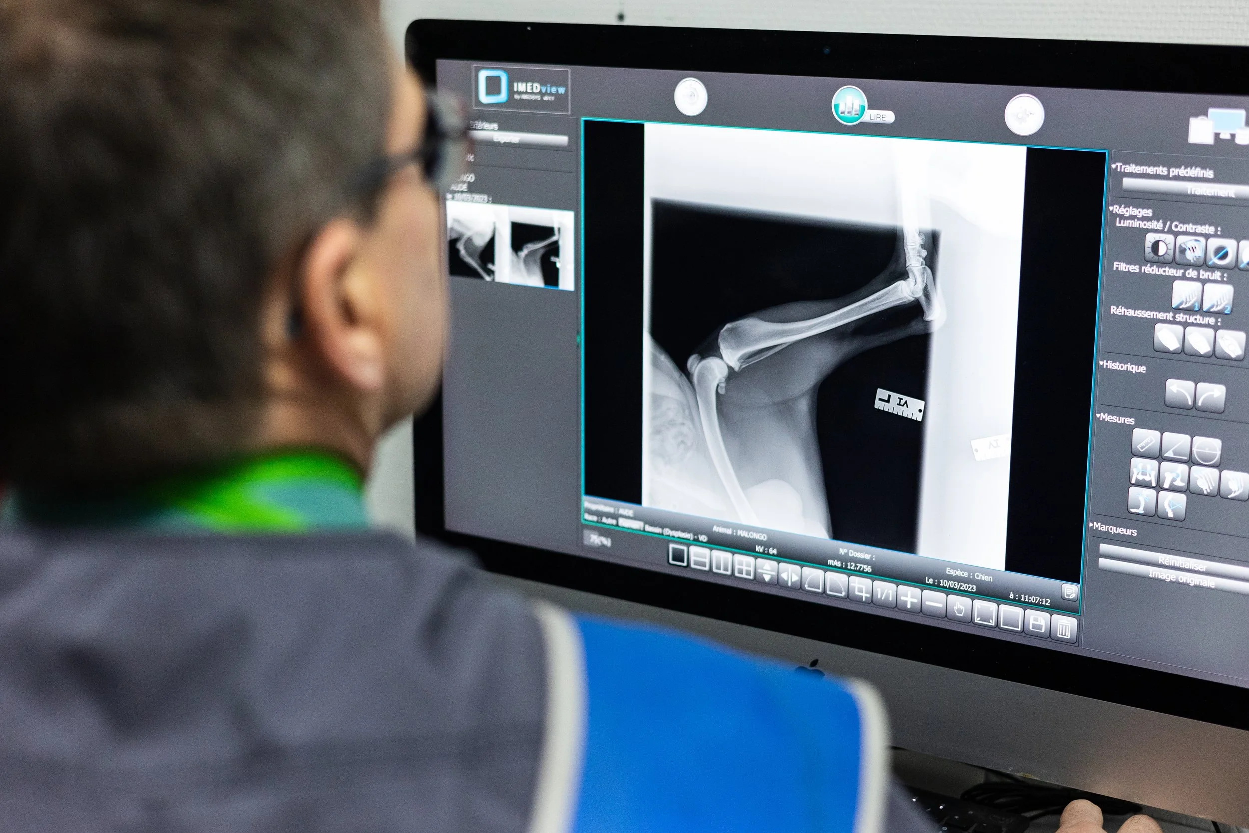 Une personne regarde un écran d'ordinateur affichant une radiographie d'un membre. La radiographie montre l'os du bras et du poignet. L'écran comporte des options de traitement et de réglage, avec un fond gris foncé et un logo 'IMEDview' en haut à ga