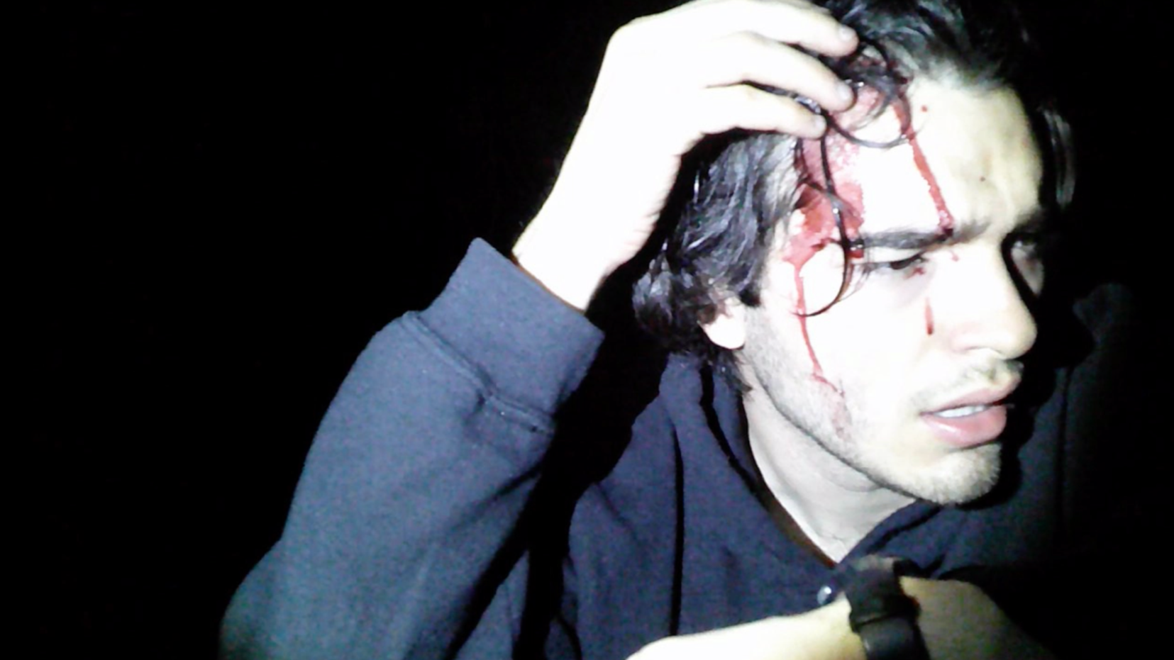 A young man with glasses and dark hair, wearing a black hoodie, appears distressed with blood on his forehead, hair, and face, and his hand clutching his head, in a dark background.