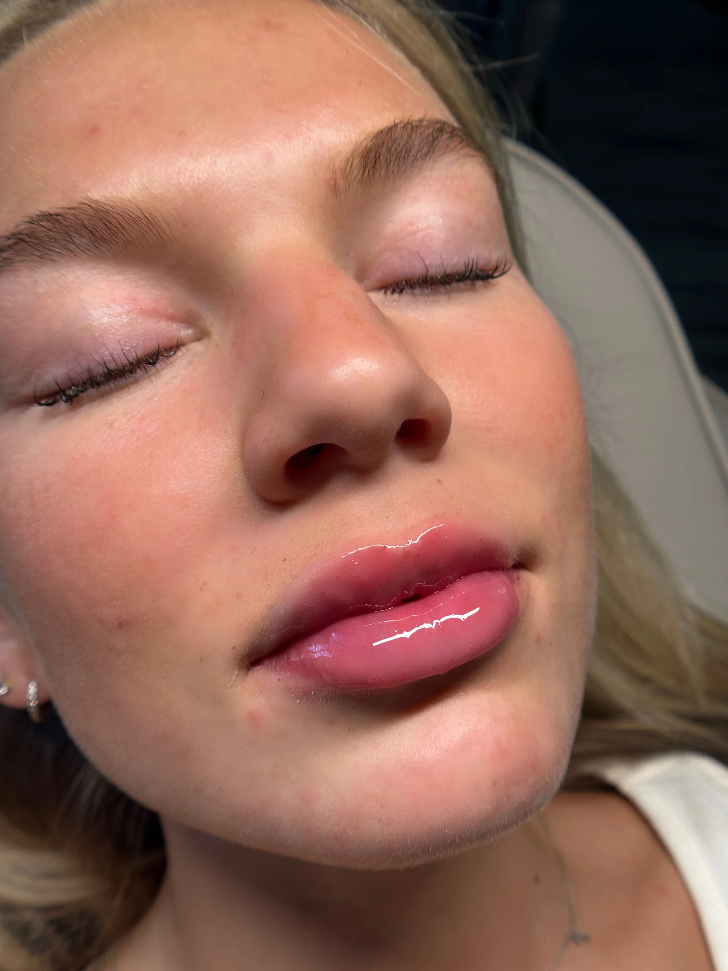 Close-up image of a young woman's face with closed eyes and glossy pink lips, showing her full, juicy lips after getting needle-free lip filler.