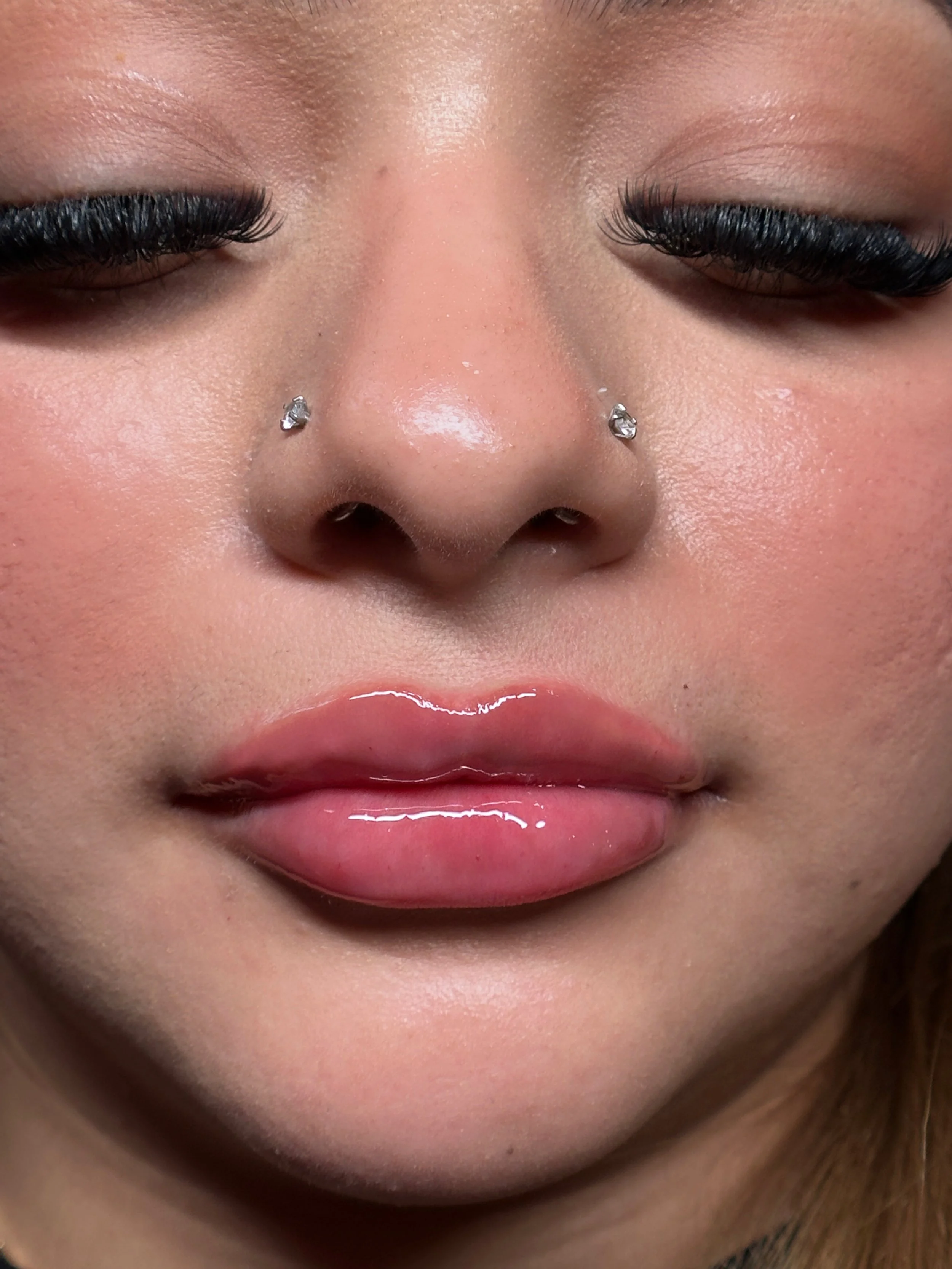 needle-less filler near me