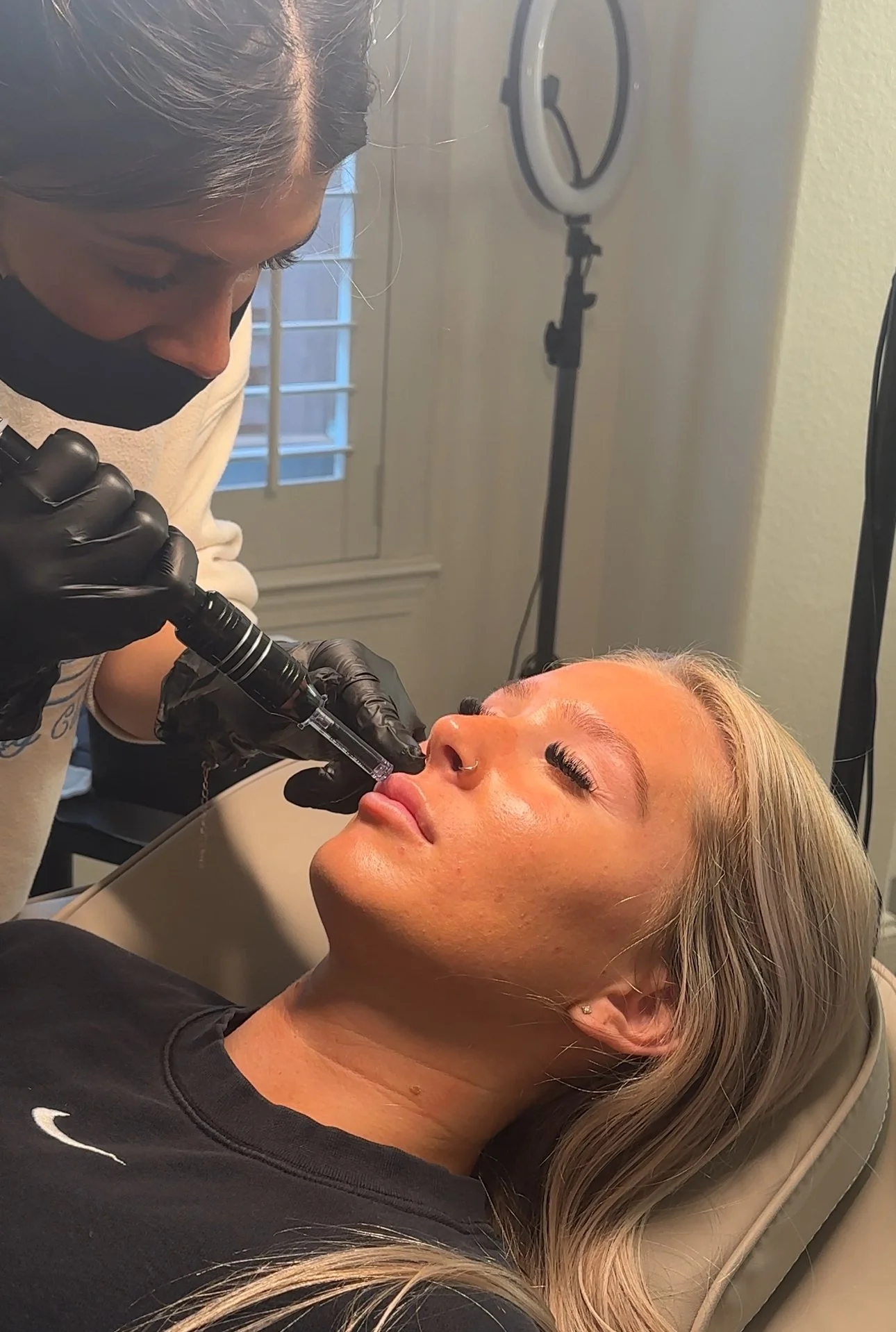 needleless lip filler roseville