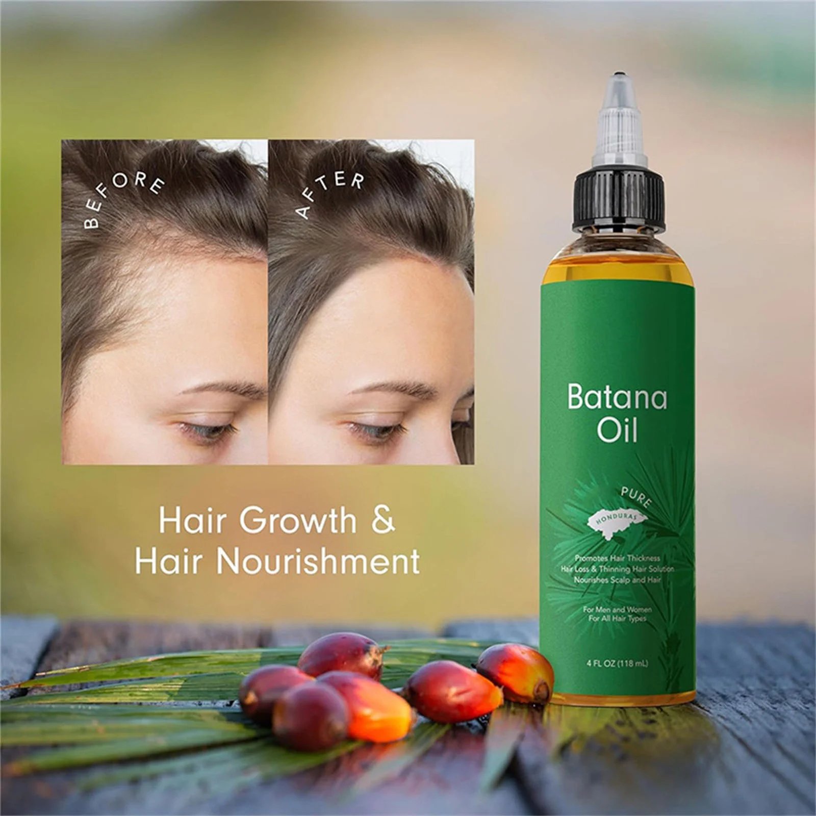 Batana Oil for Hair Growth – 100% Pure & Organic | 4 fl oz | Natural Hair Growth & Deep Conditioning Oil for Damaged Hair, Eyelashes, Eyebrows & Skin