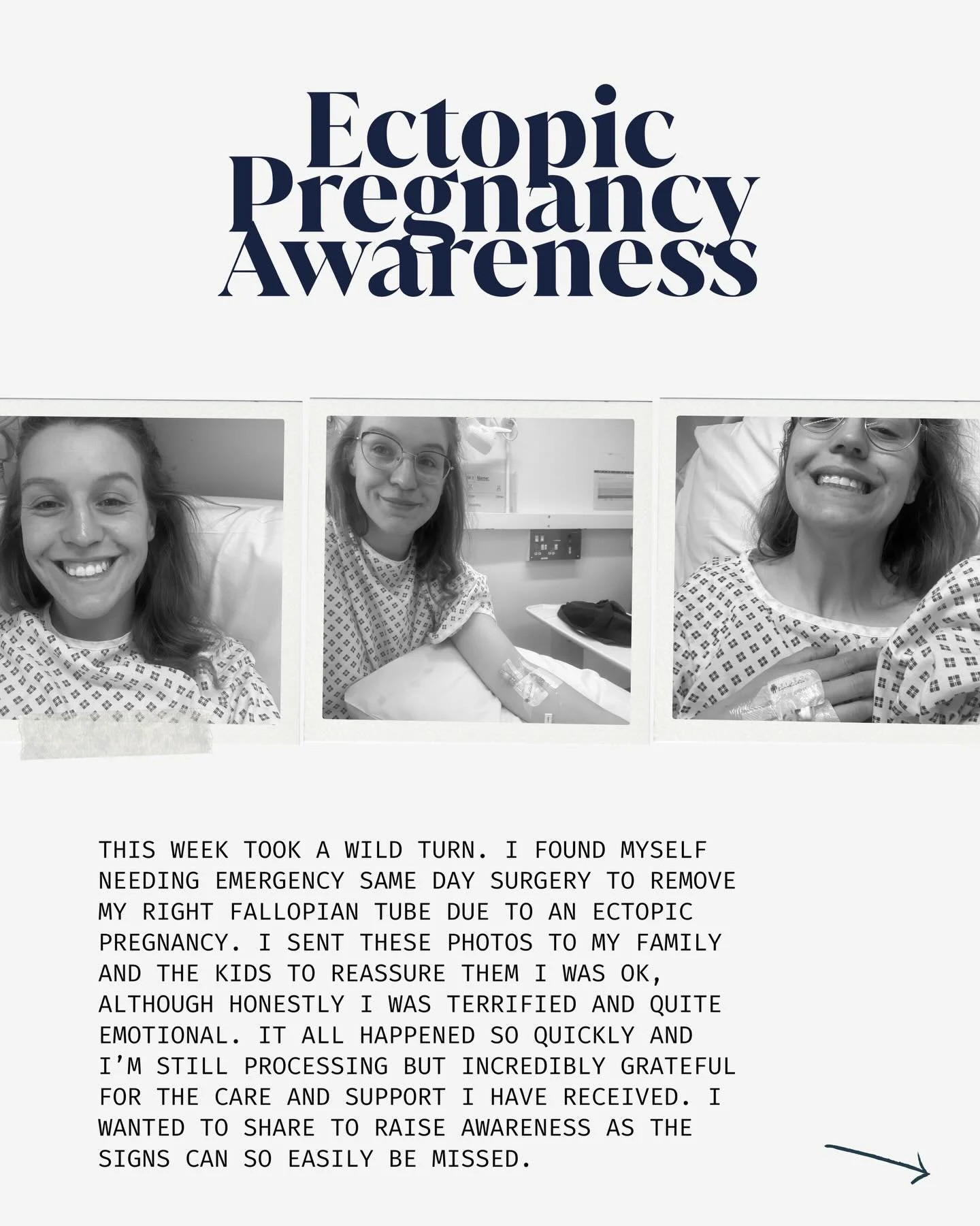 I wanted to share a little more detail here, because the symptoms of an ectopic pregnancy aren&rsquo;t always obvious and early diagnosis can make a huge difference in preventing serious complications.

Signs and symptoms to look out for: &bull; Lowe