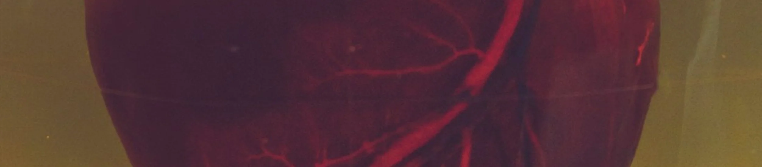 Too Bad, You Have To.