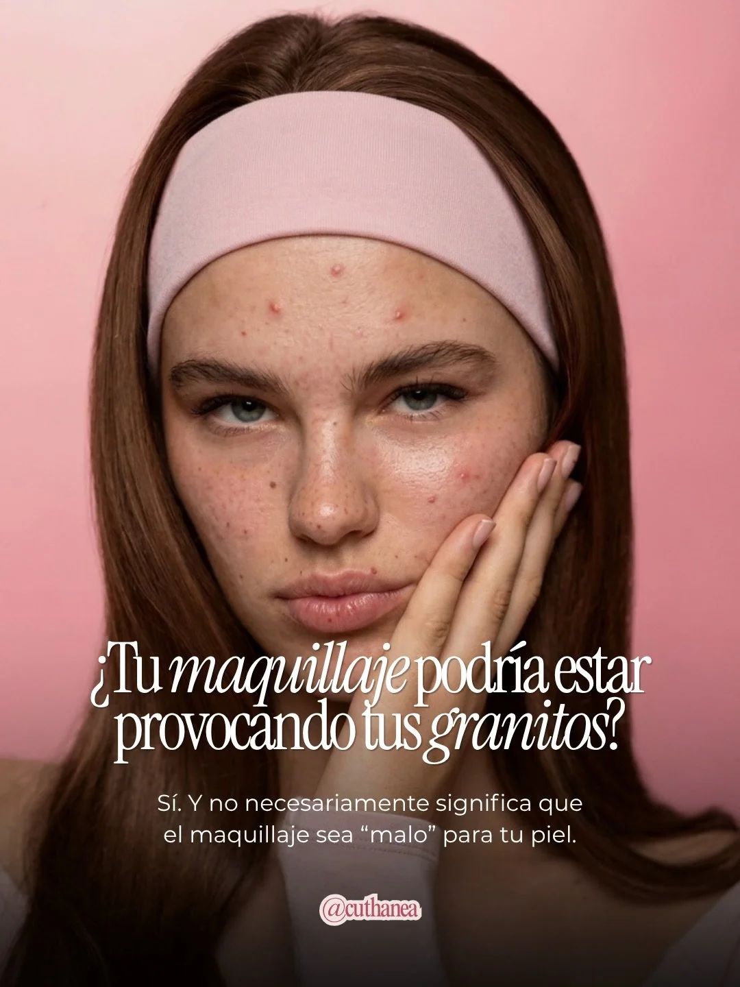 &iquest;Cambiaste de maquillaje y empezaron los granitos? 👀 

Te contamos qu&eacute; es el acn&eacute; cosm&eacute;tico y qu&eacute; significa realmente &ldquo;no comedog&eacute;nico&rdquo;. 🫧

#AcneCosmetico #MaquillajeNoComedogenico #PielConAcne 