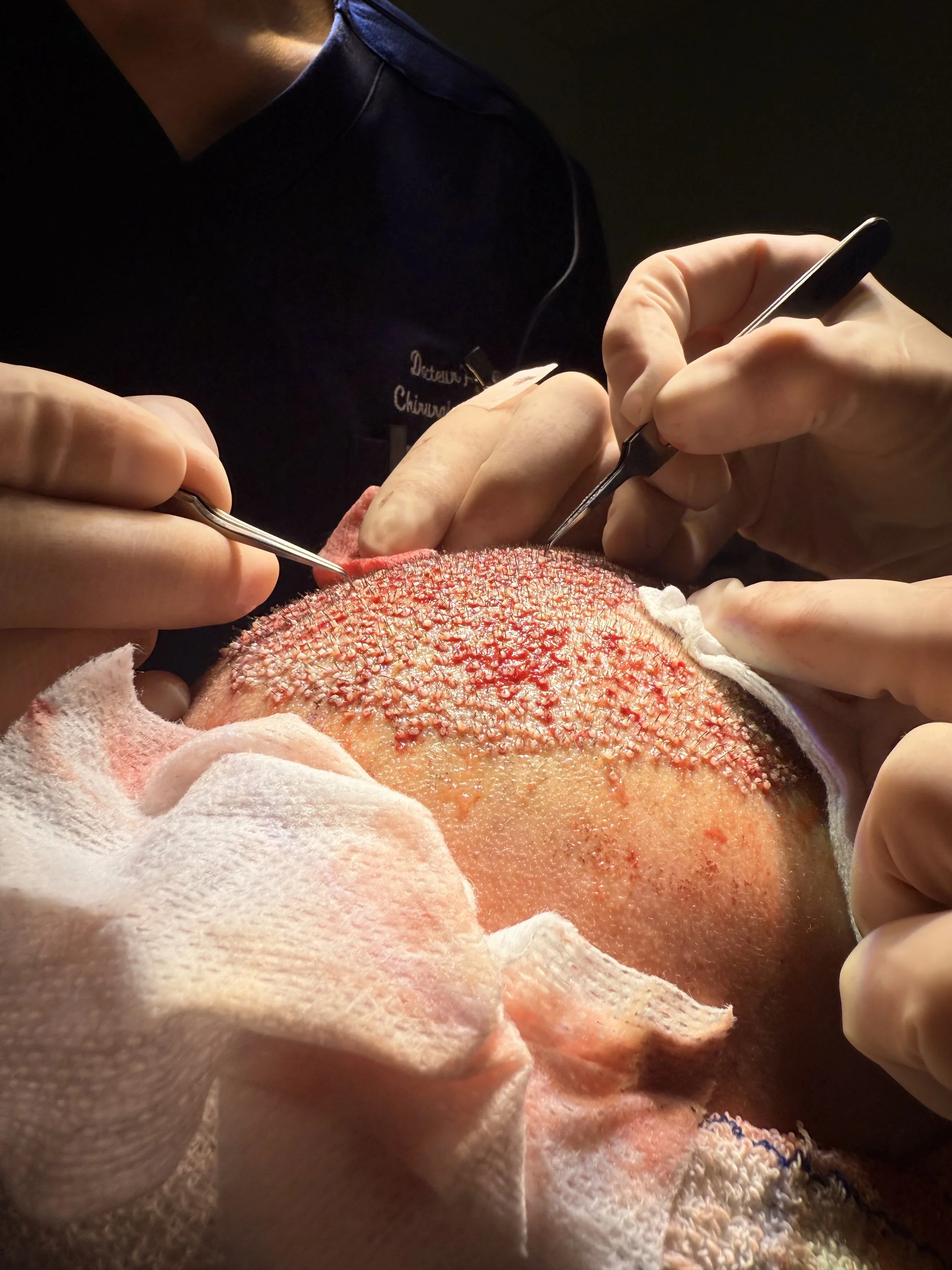 13. Verification finale - 100% des greffons en place.jpeg