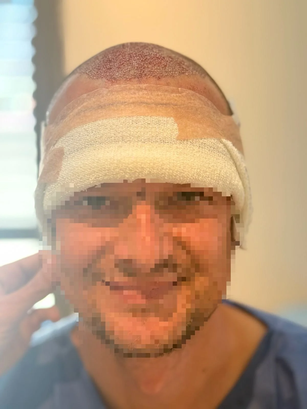 14. pansement final de face.jpg