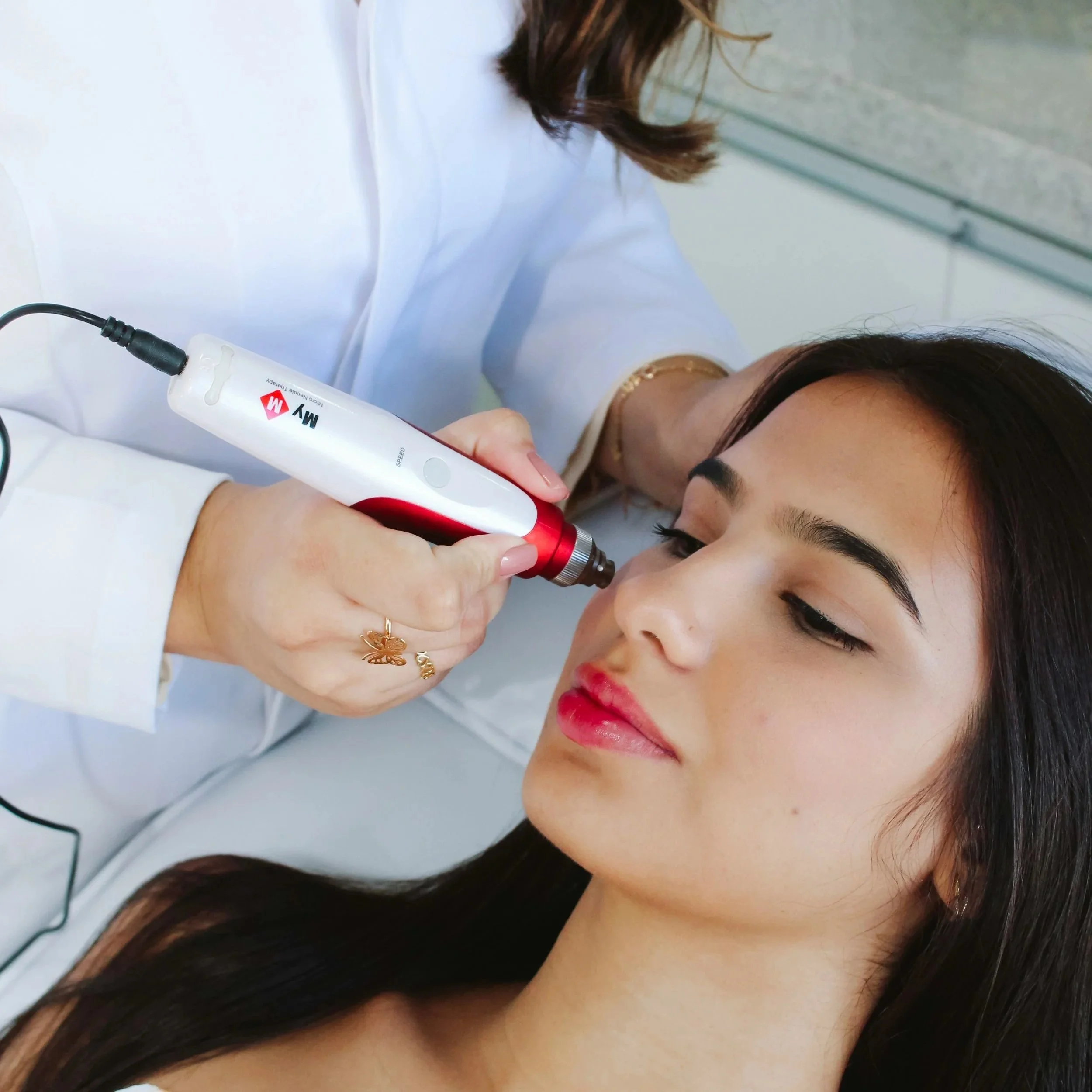The Real Reason Microneedling Is Everywhere Right Now