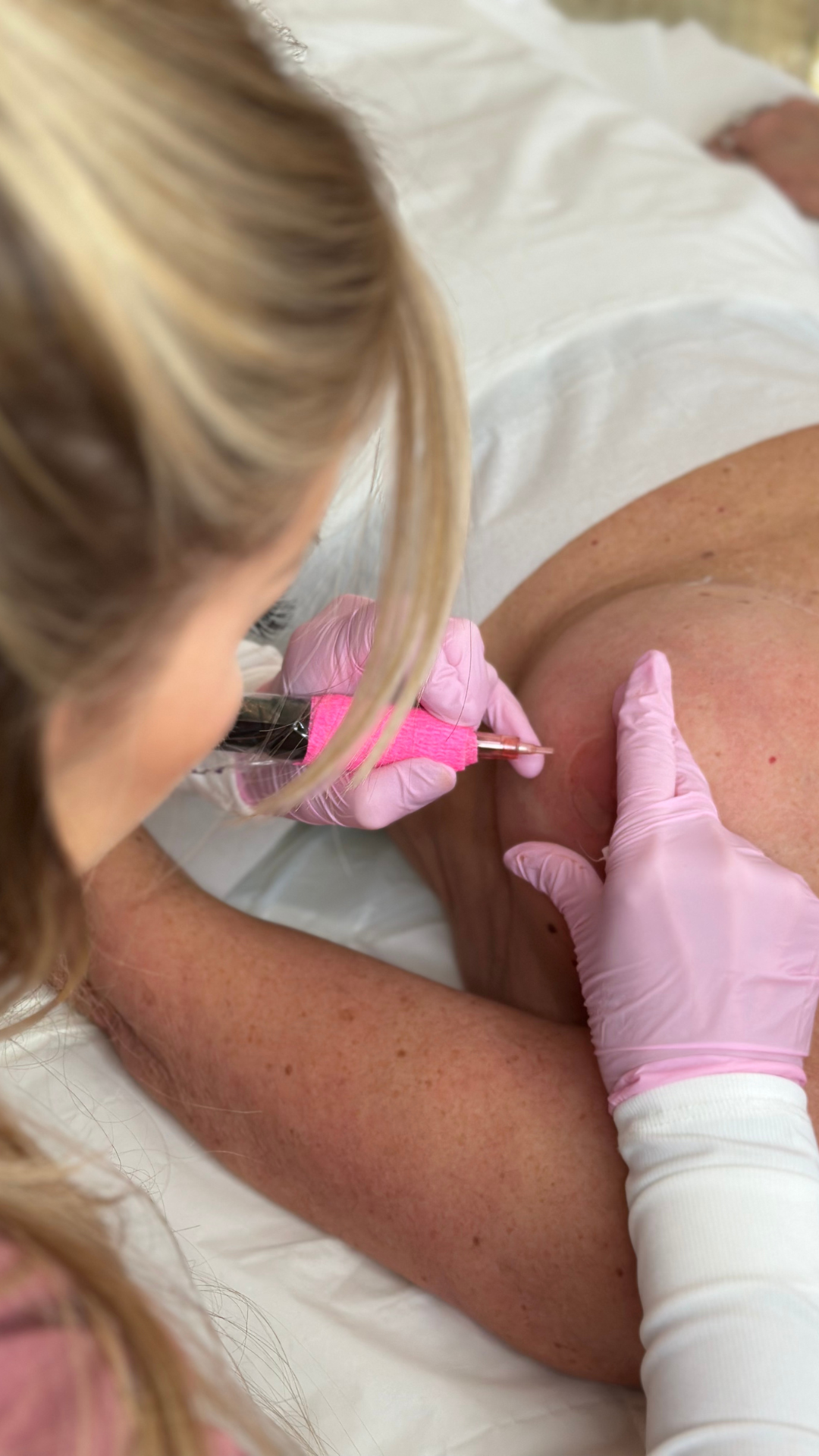 A healthcare professional administering an injection into a patient's upper arm using a syringe. The professional is wearing pink gloves and the patient has short, freckled skin.