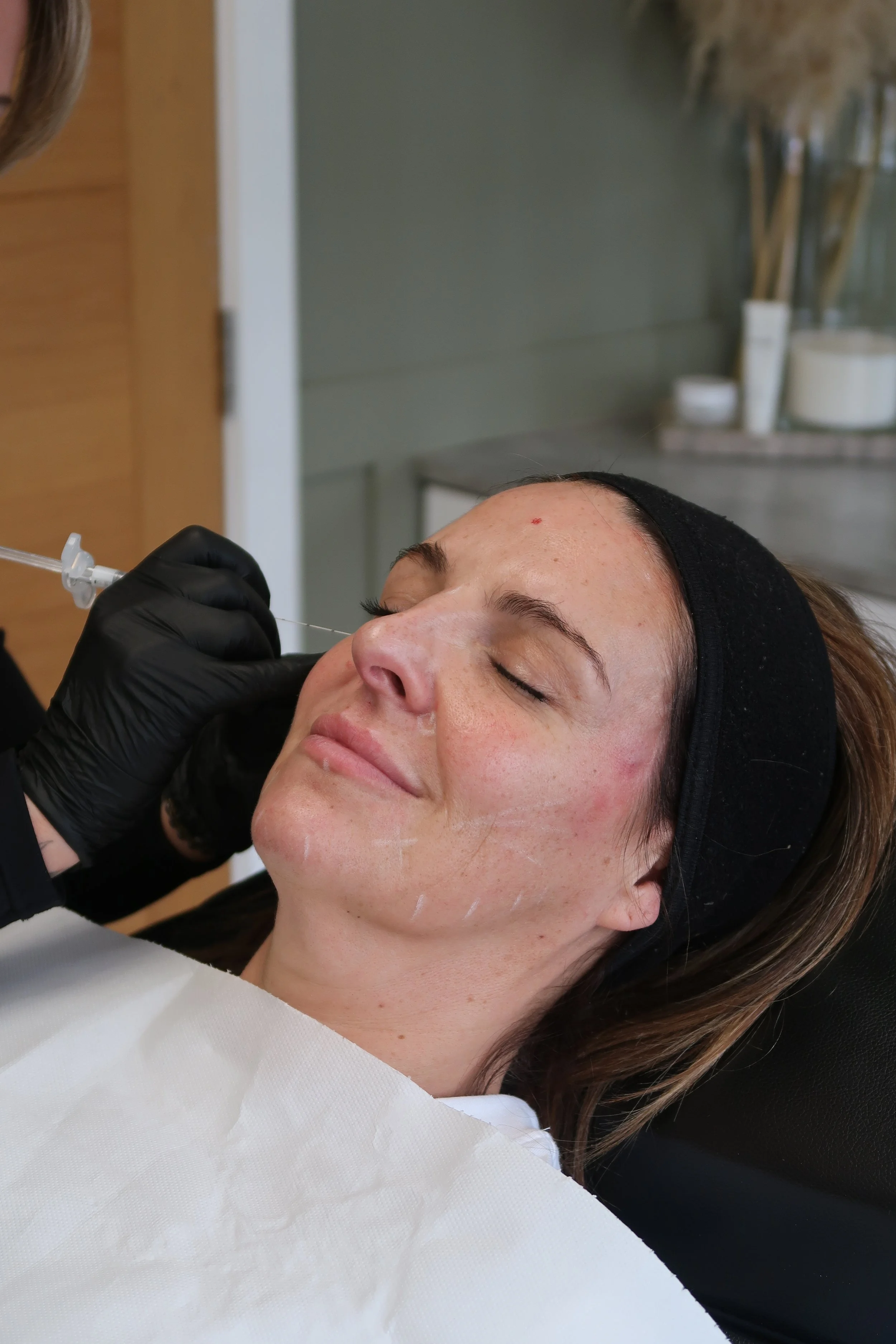 A woman is lying down with her eyes closed, receiving a cosmetic injection in her face from a medical professional wearing black gloves in a clinic setting.