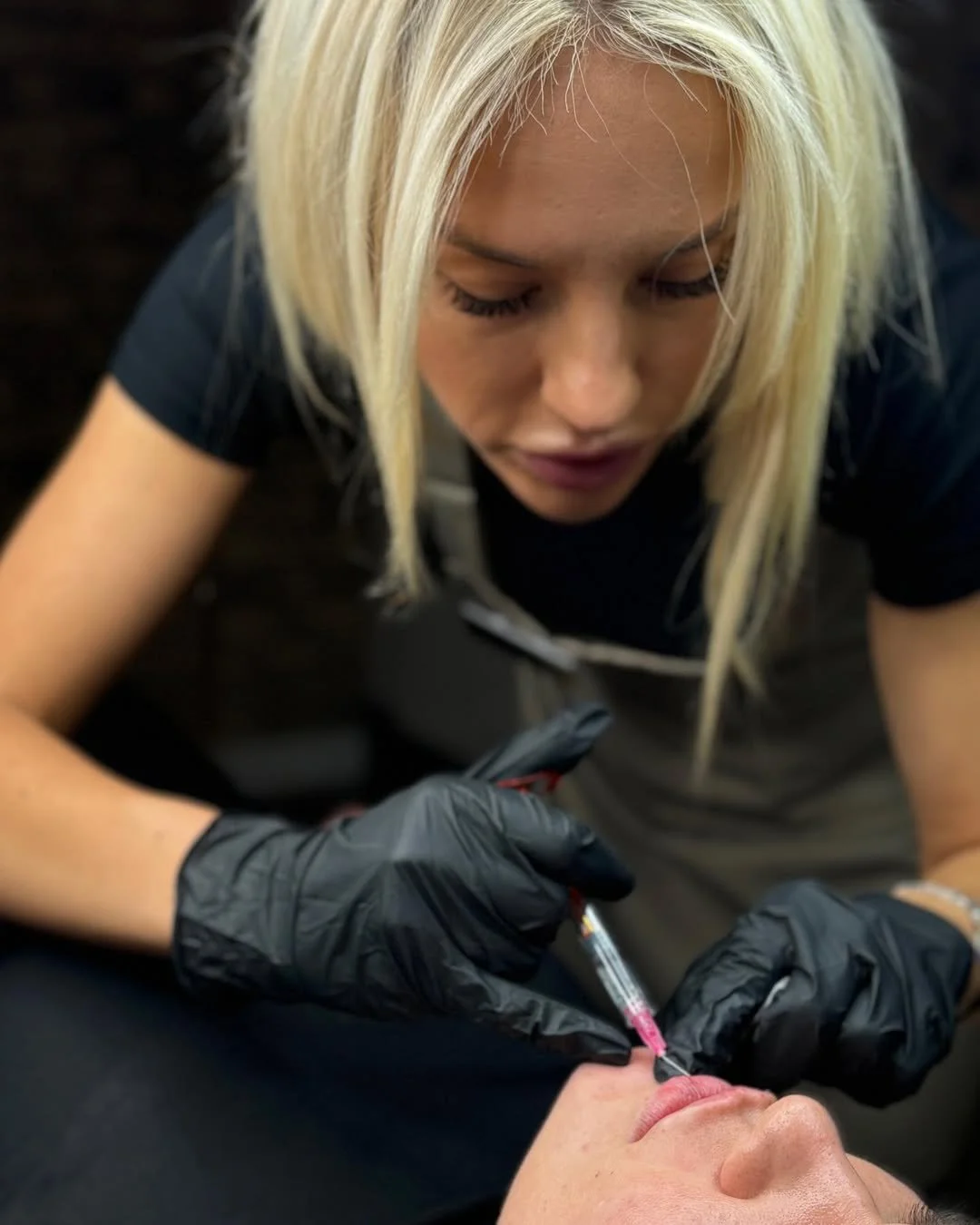 A woman in black gloves giving a cosmetic injection to a person's lips.