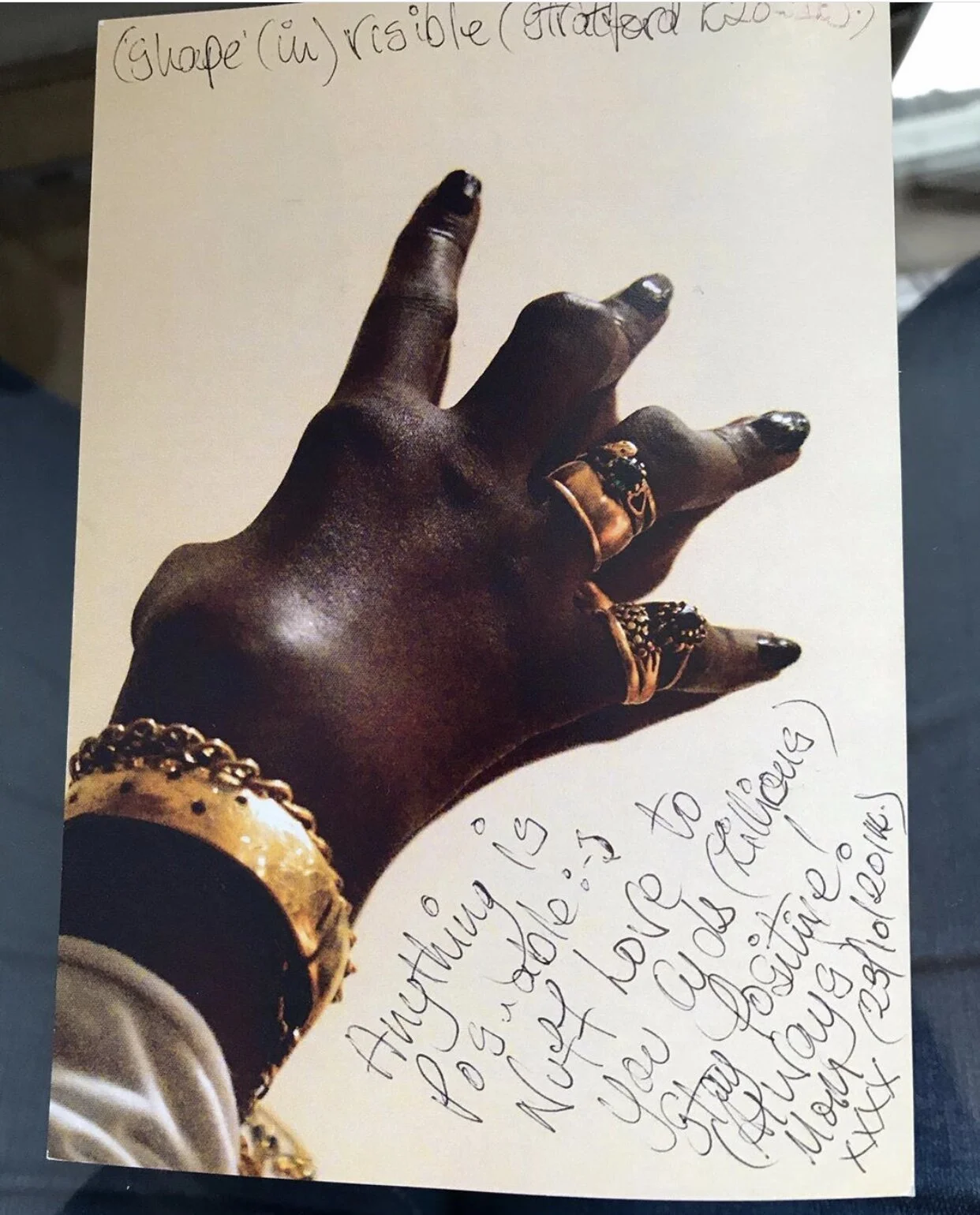 A hand severely affected by rheumatoid arthritis on an empowering hand written card