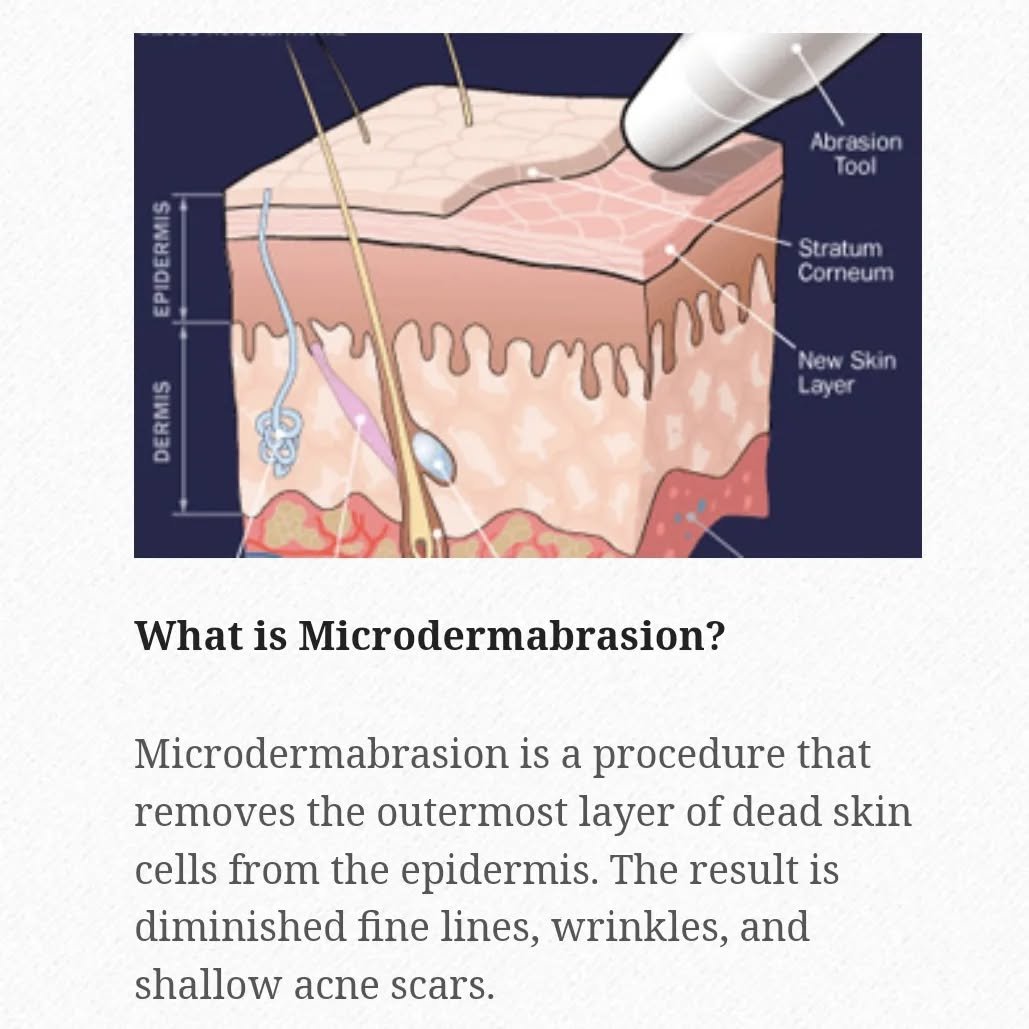 Why is microdermabrasion such a great tried and true treatment? 

#microdermabrasion #antiaging #highperformanceskincare #exfoliation #facial