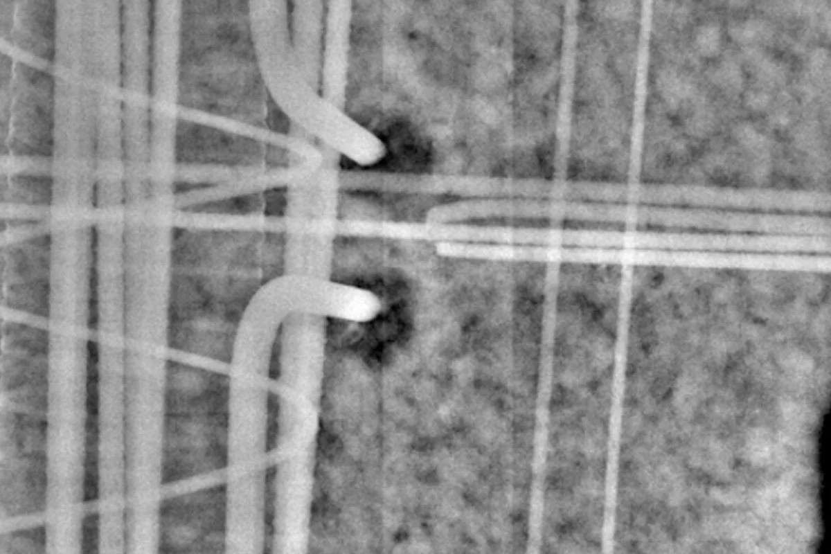 Concrete Scanning vs X-Ray: What’s the Difference?