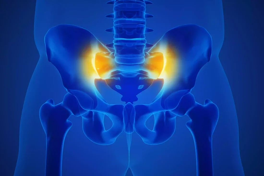 Understanding Sacroiliac (SI) Joint Dysfunction: Causes, Symptoms, and Treatment Options