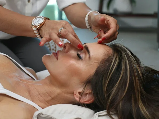 Cosmetic Facial Acupuncture