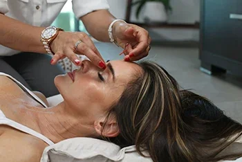 Cosmetic Facial Acupuncture