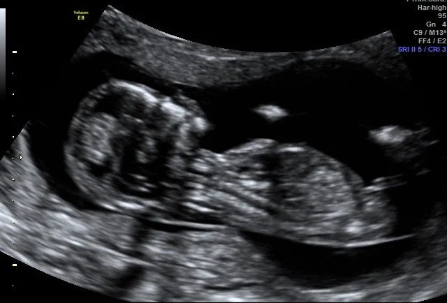 antenatal GP lactation support