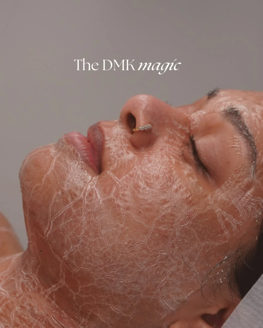 Loving all things Skyn 🤍 

Capturing all the finer details of your treatment. 

#skinclinic #socialmediacontentcreator #contentcreation #cameraquality #sydneycontent