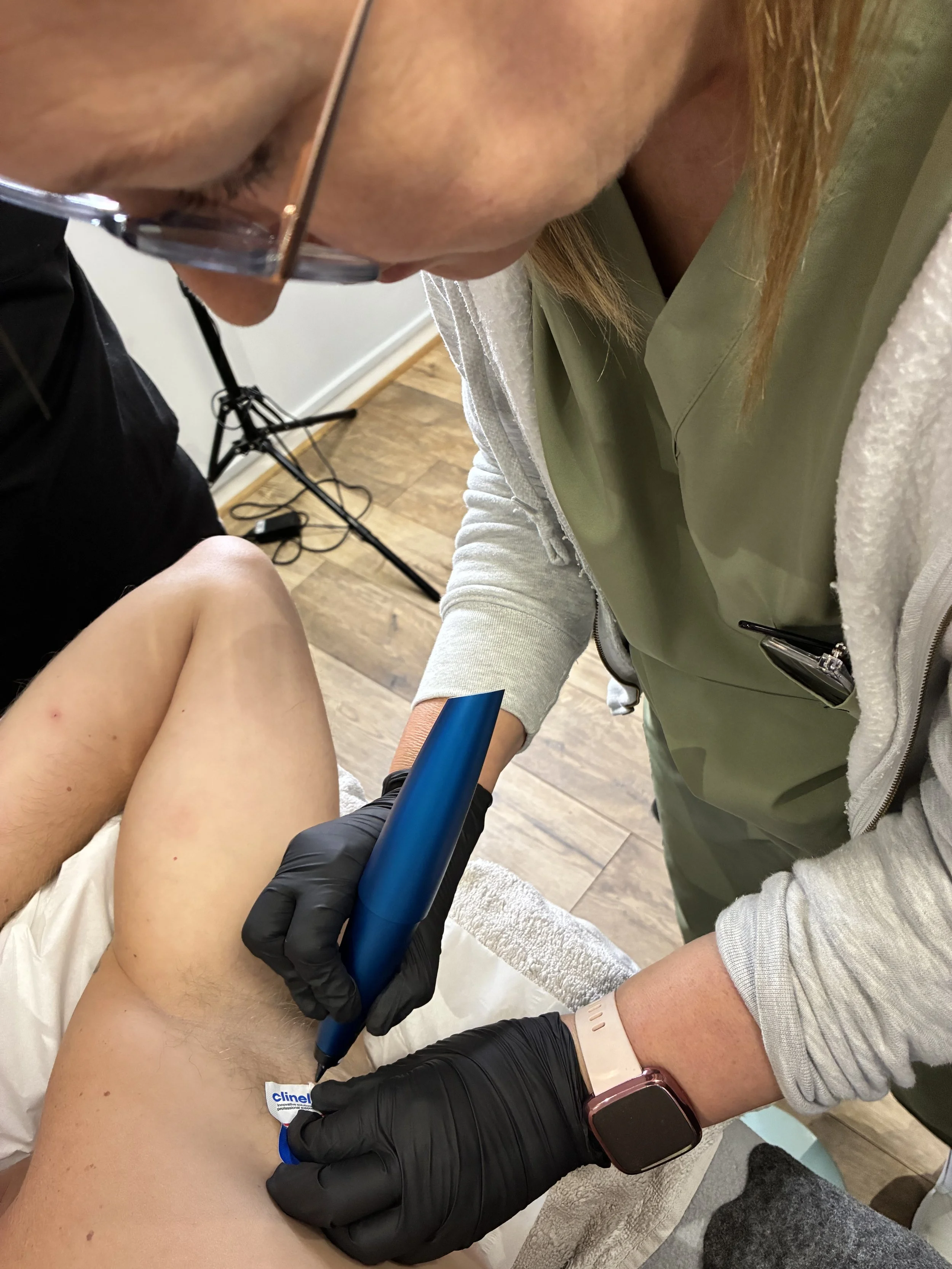 mole removal and skin tag removal in Weymouth Dorset at Weymouth Aesthetics Clinic, medically led by paramedic Donna