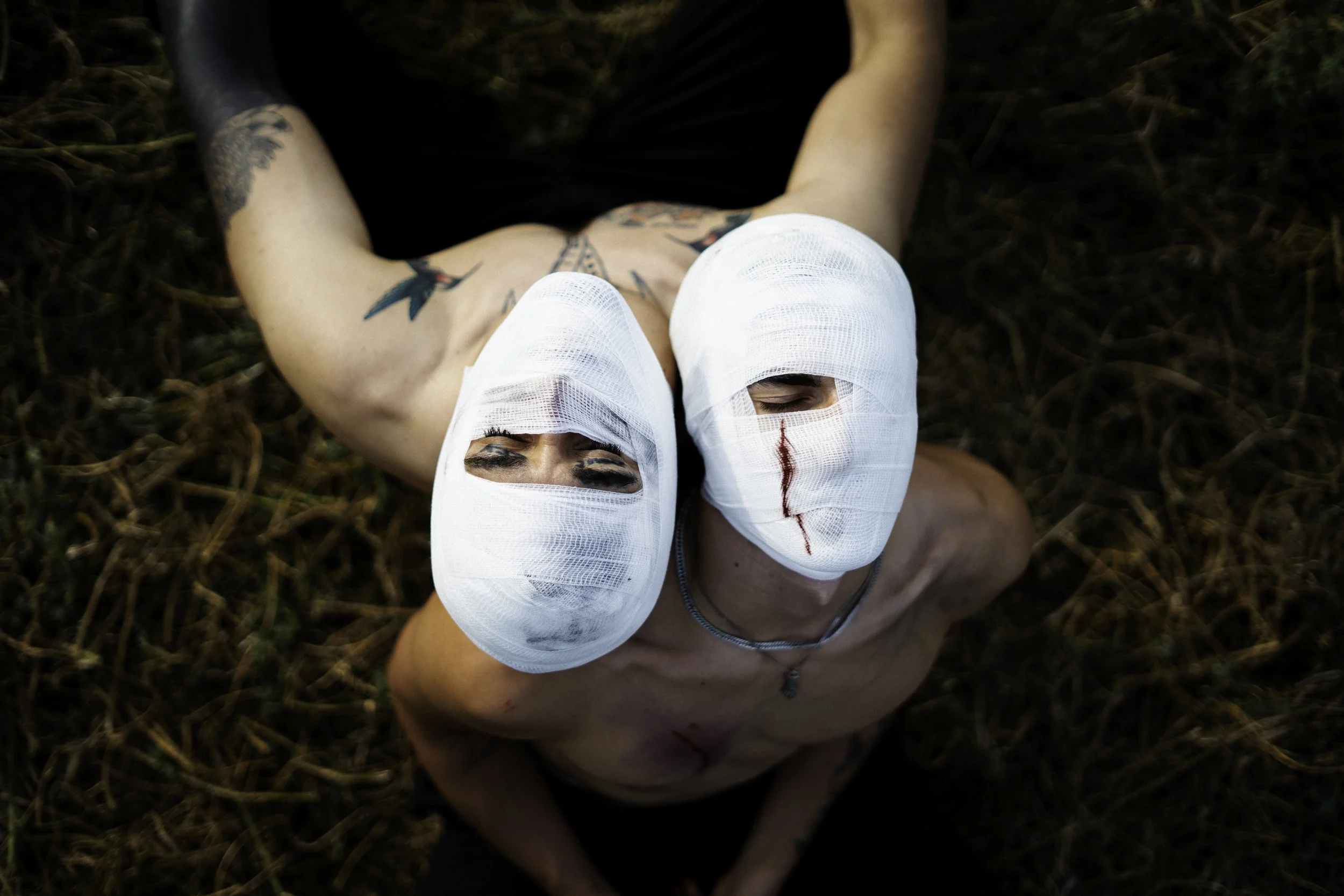 Deux personnes allongées dans l'herbe, leurs têtes bandées avec des pansements, l'une avec une cicatrice sur le visage.