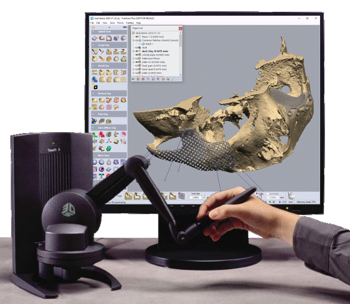 Person using a digital 3D scanning device connected to a computer displaying a 3D model of a skull.