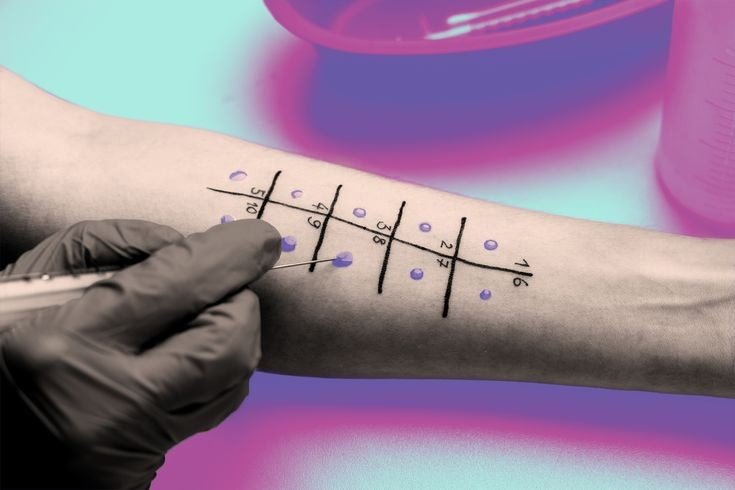 Allergy Testing - Diagnostic Procedure to Identify Allergies and Sensitivities
